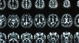 Кадр з фільму Поцілунок Беатріс